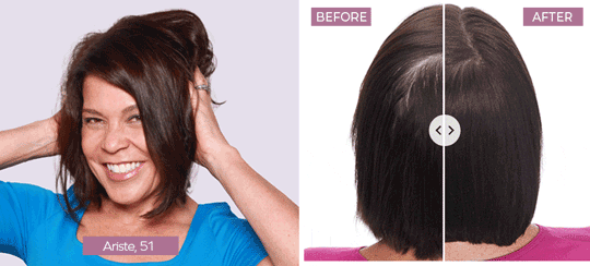 Keranique® Hair Regrowth System results for thicker-looking hair