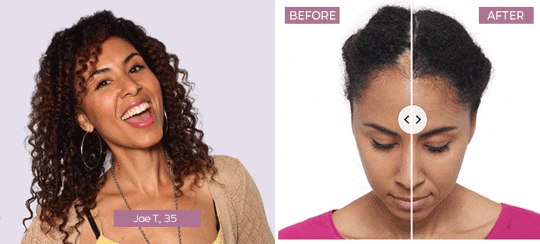 Keranique® Hair Regrowth System fuller healthier-looking hair